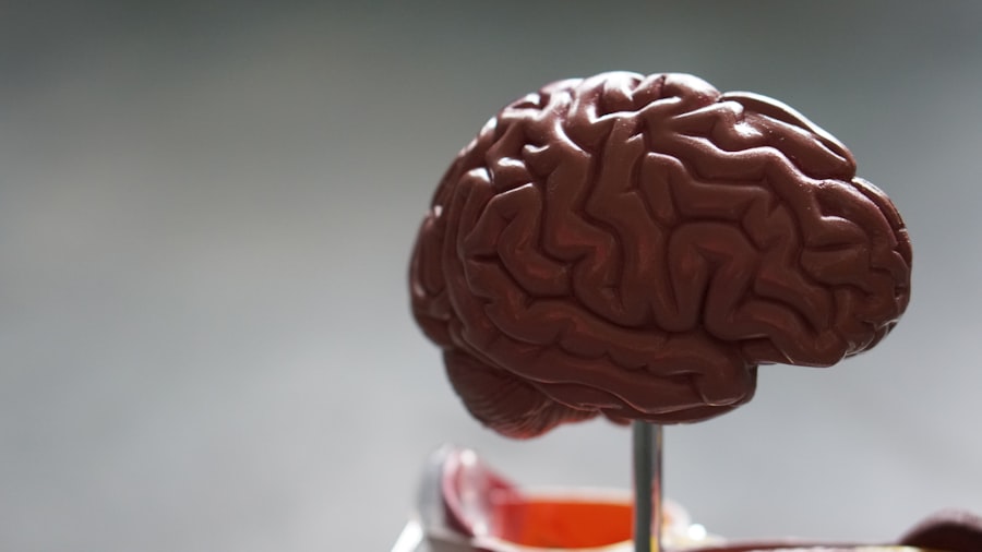 Photo Brain Rot